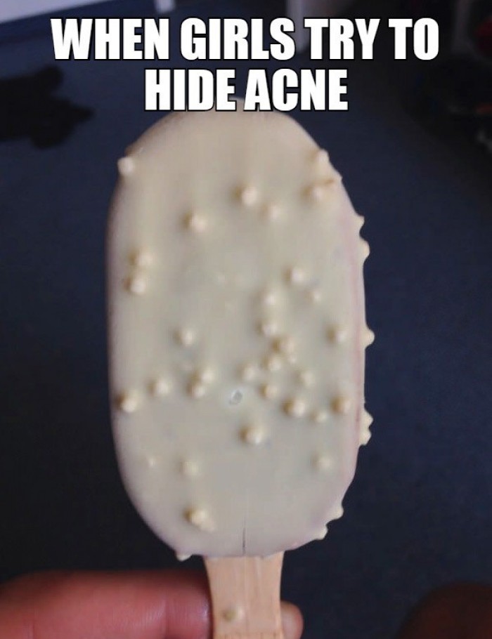 When girls try to hide acne